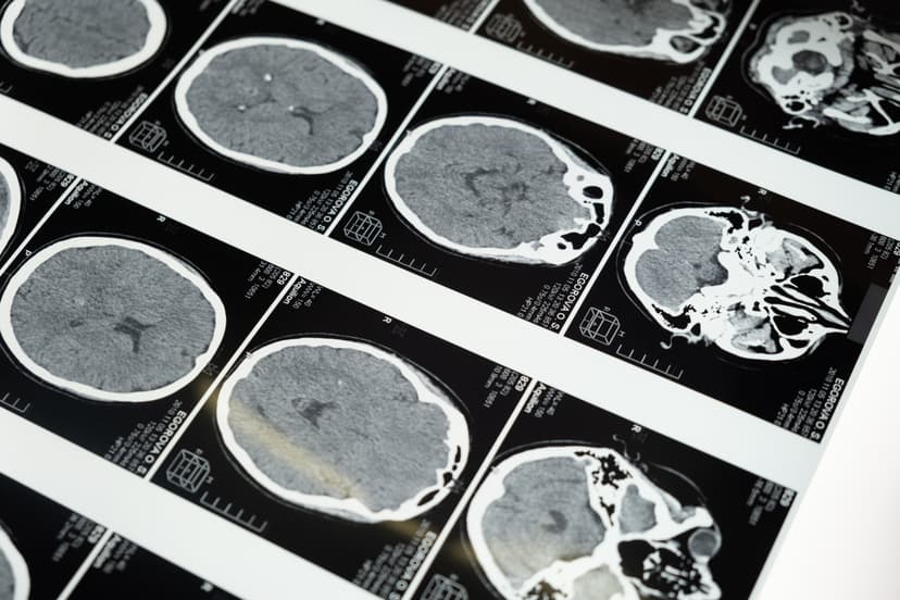CT Scan