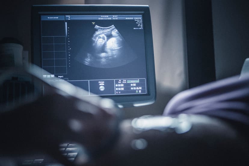 Ultrasound