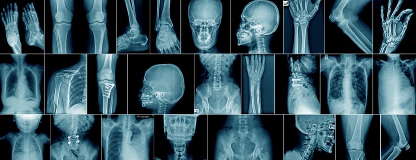 Digital X-ray